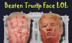 Beaten Trump Face LOL